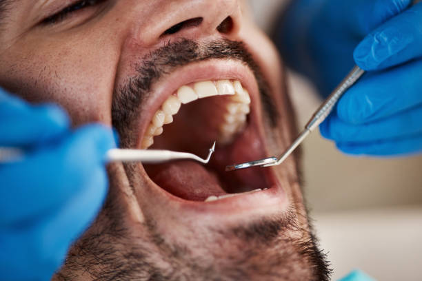 Laser Dentistry in Sparks, TX